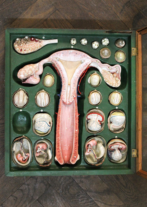 uterus_auzoux_veille