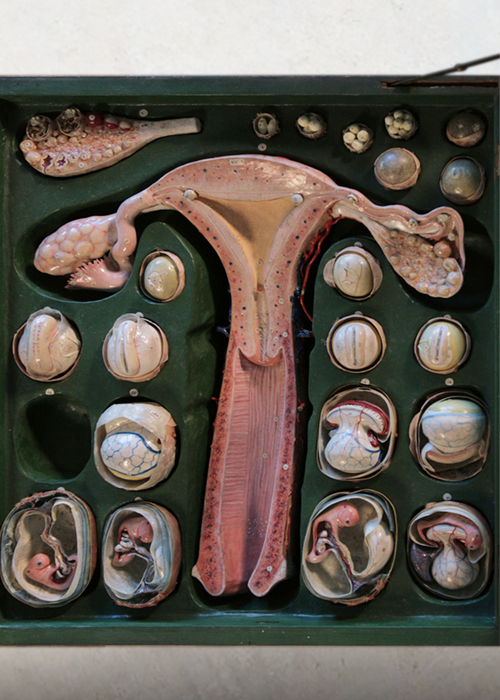 uterus_auzoux_veille1